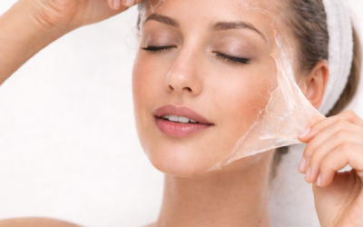Chemical peels: everything you need to know before starting a course of treatment